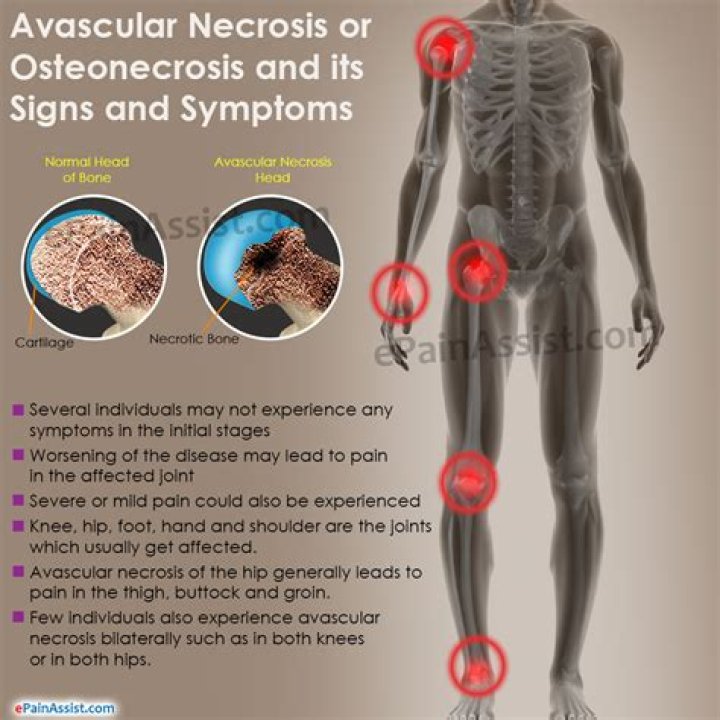 Are bones vascular or avascular?