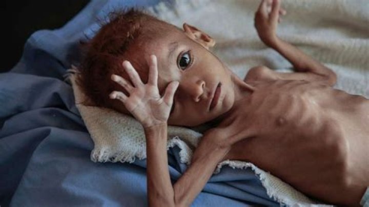 Are famine and starvation difference?