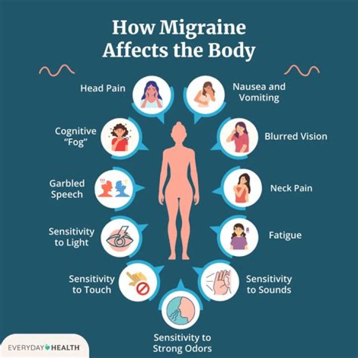 Are migraine a symptom of covid?