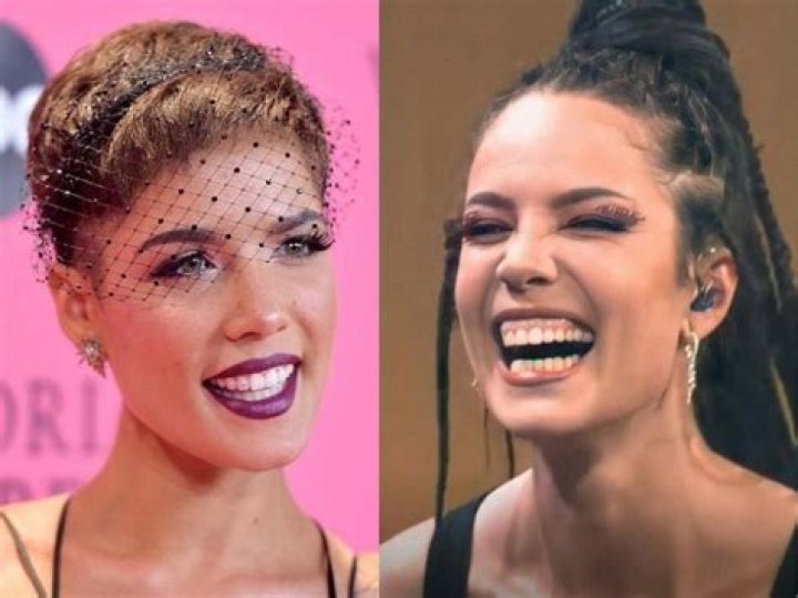 Are roberto firmino's teeth real?