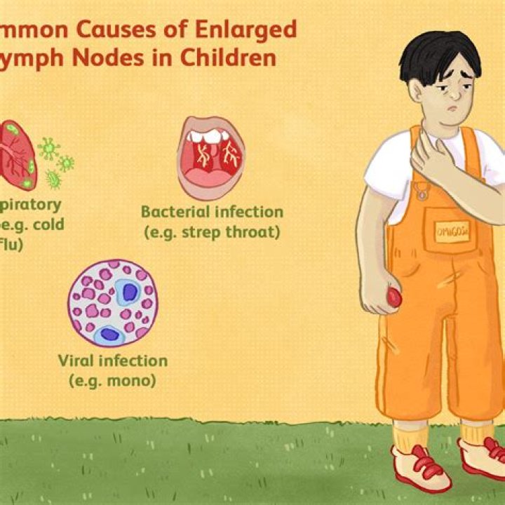 Can allergies cause swollen glands?