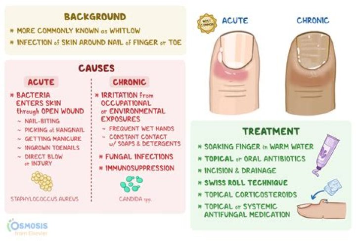 Can paronychia cause fever?
