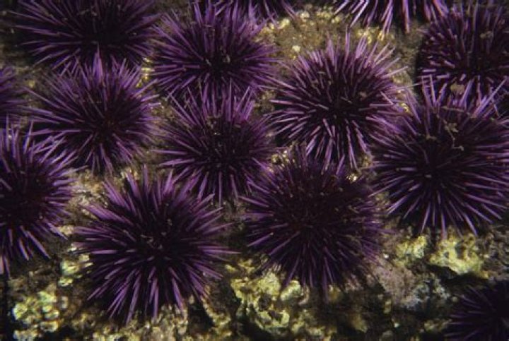 Can sea urchins kill you?
