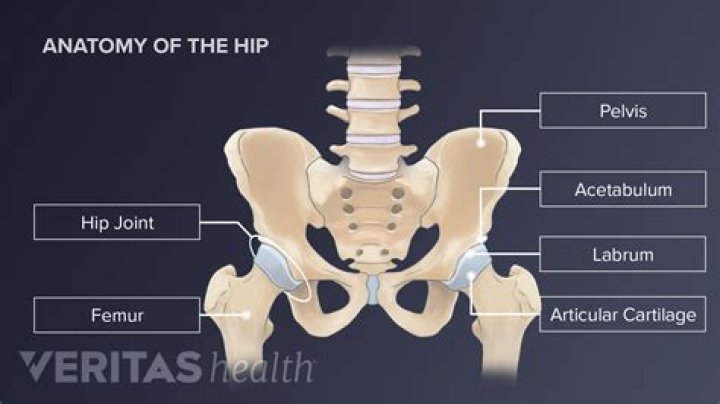 Can you chip your hip bone?