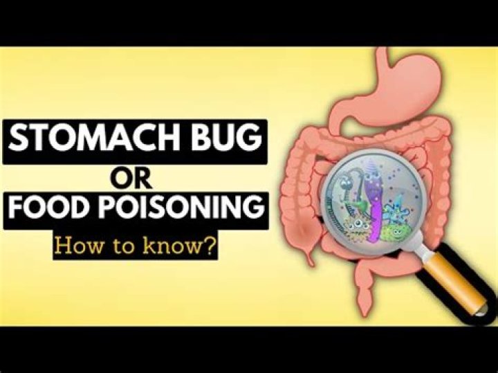 Can you have gastro without vomiting?