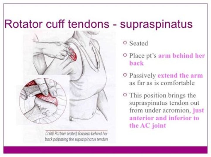Can you palpate supraspinatus?