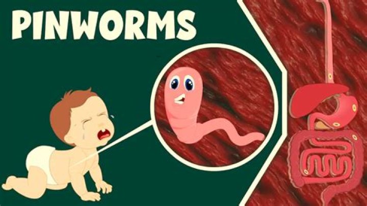 Can you see pinworms?