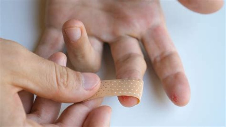 Do bandages have medicine in them?