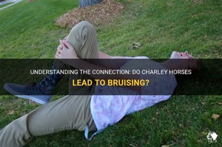 Do charley horses cause bruising?