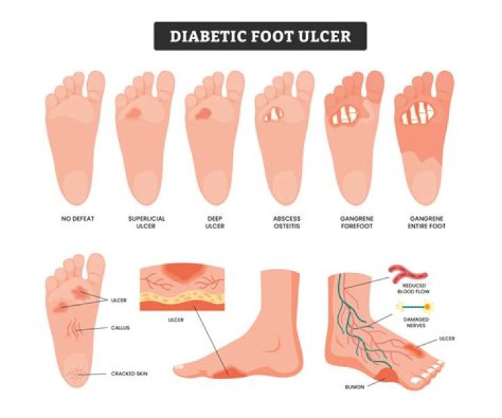 Do diabetic foot sores itch?