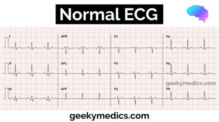 Do i need an echocardiogram?
