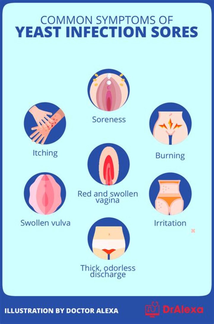 Do liners cause yeast infections?