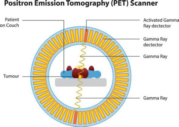 Do pet scans use radioisotopes?