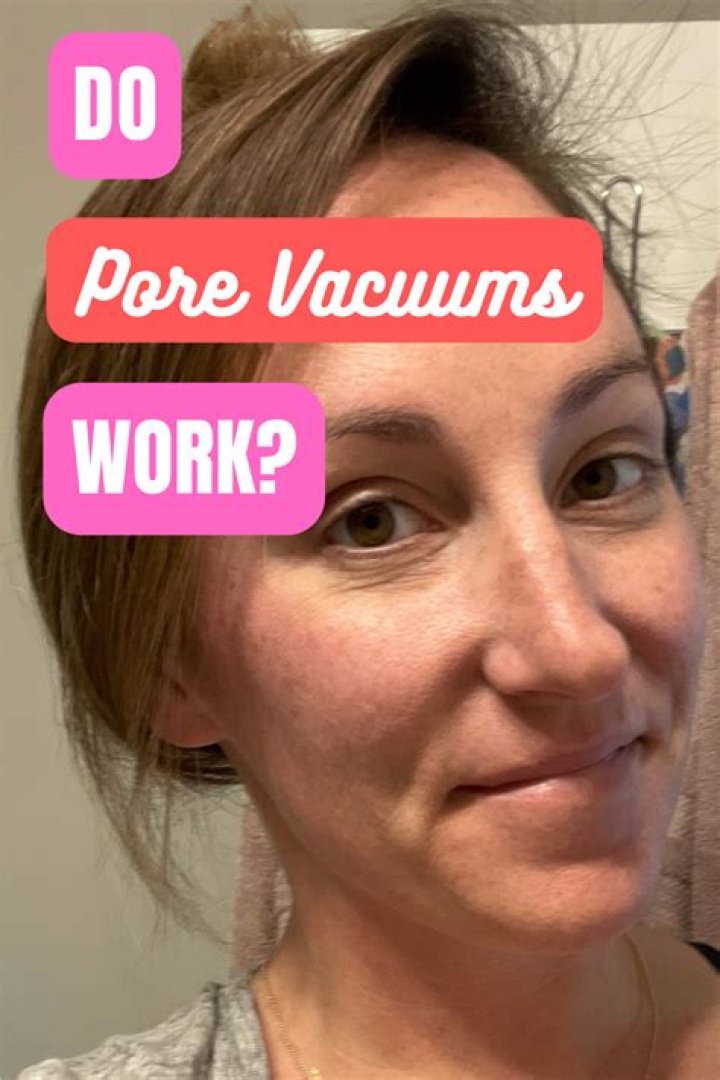 Do pore suctions work?