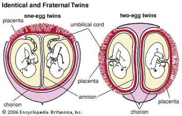Do twins run on maternal side?