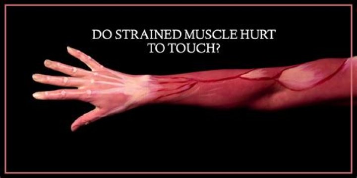 Does a strained muscle hurt to touch?