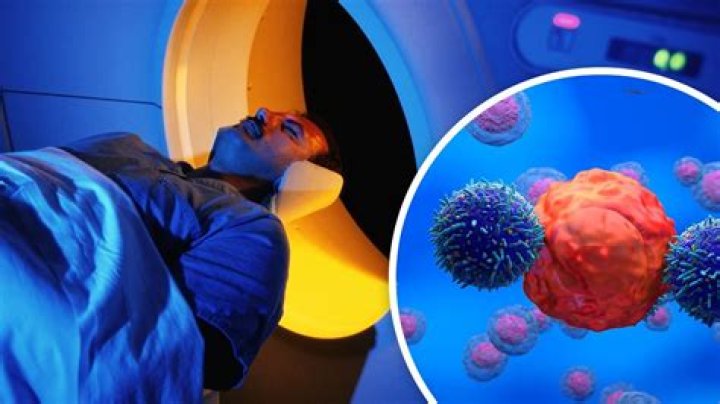 Does ct scan cause cancer?