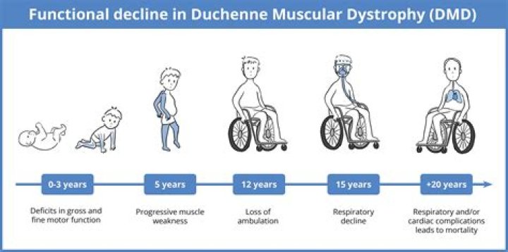Does dmd only affect males?