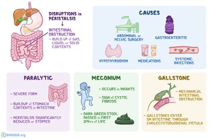 Does pancreatitis cause ileus?