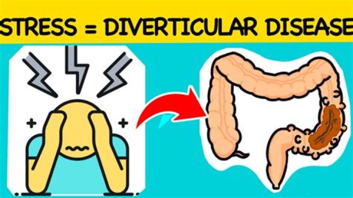 Does stress affect diverticular disease?