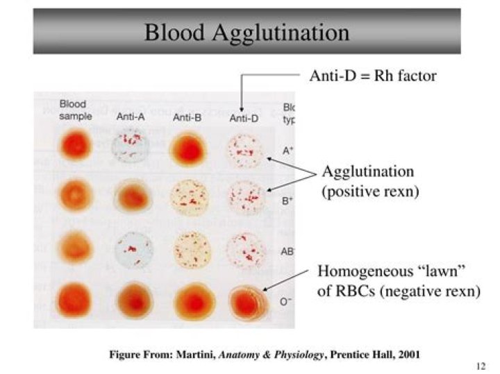 Does type o blood agglutinate?