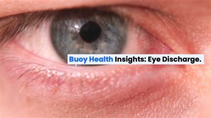 Has discharge from eye?