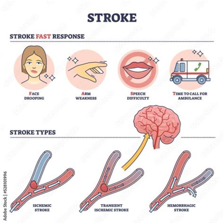 How do strokes happen?