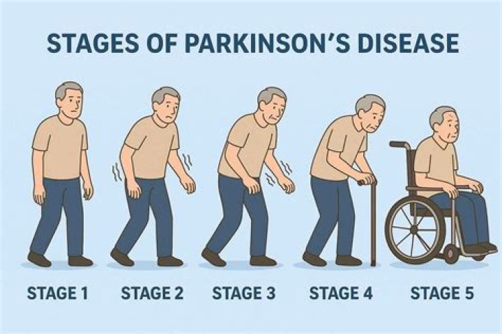How hereditary is parkinson's disease?