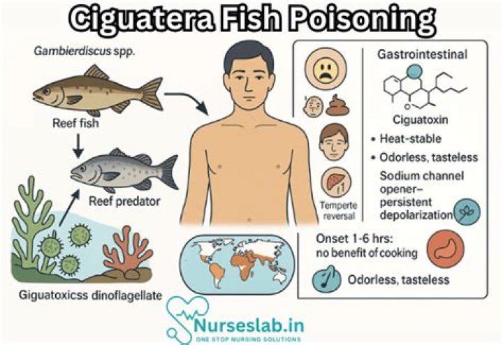 How is ciguatera treated?