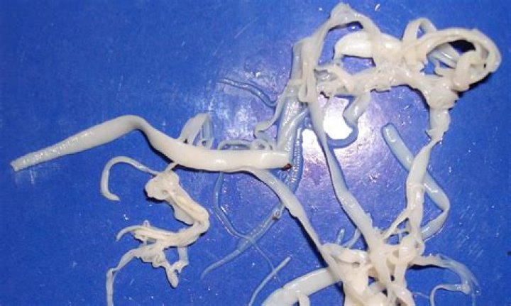 How tapeworm enters the brain?