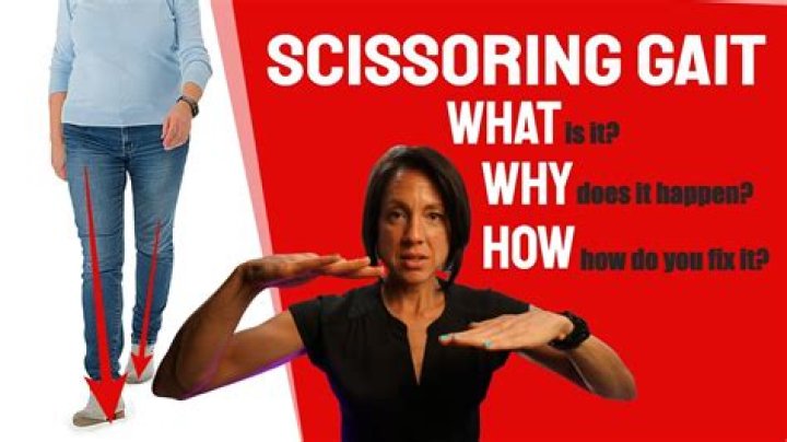 How to correct scissoring gait?