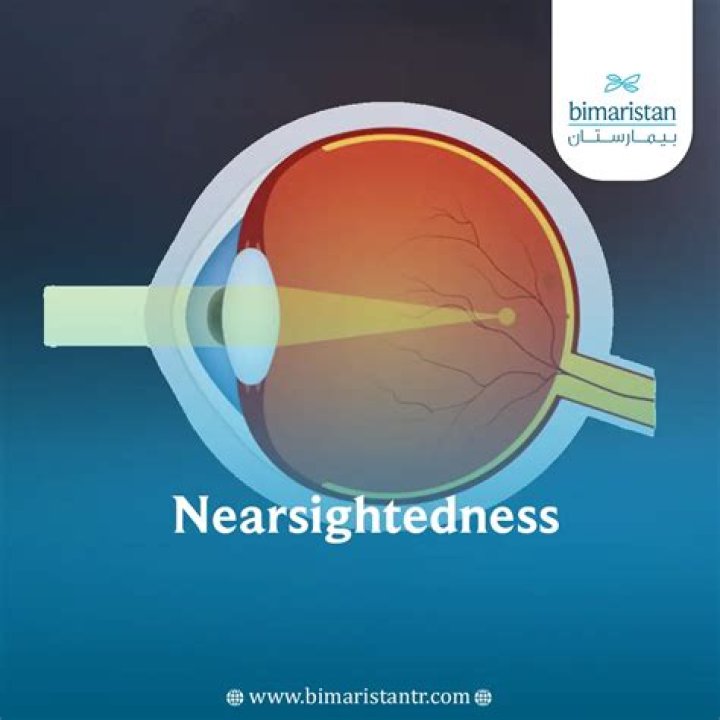 How to cure nearsightedness?