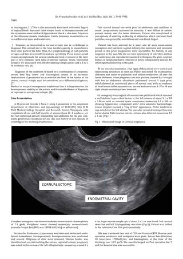 How to diagnose cornual pregnancy?