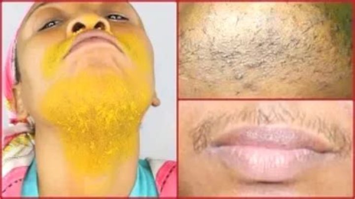 How to stop chin hair from growing?