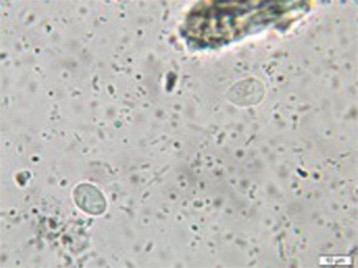 Intestinal flagellates in stool?