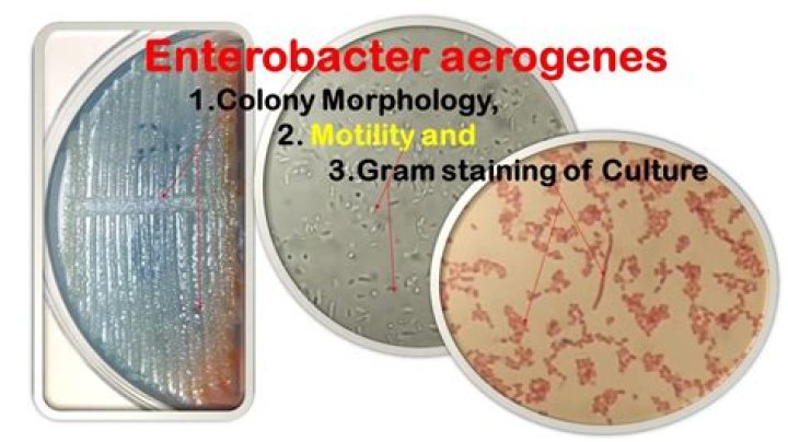 Is aerogenes gram positive or negative?