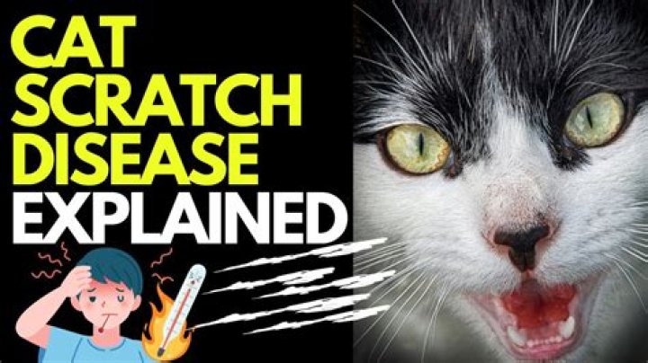 Is cat scratch rabies?