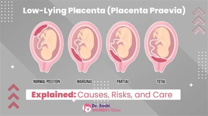 Is it safe to travel with low lying placenta?