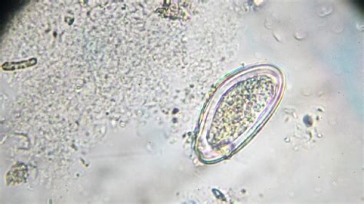 Is pinworm a bacteria?
