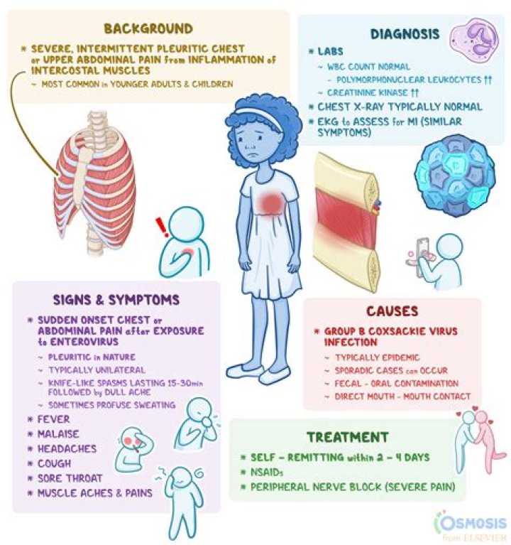 Is pleurodynia a virus?