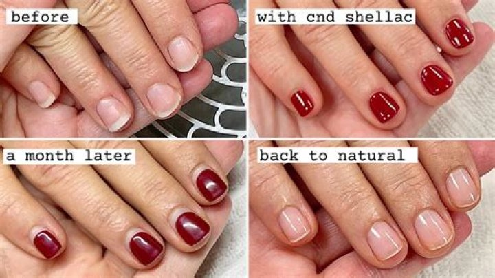 Is shellacking bad for your nails?