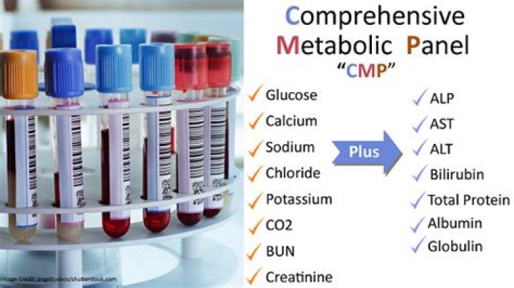 On a comprehensive metabolic panel what is alt?
