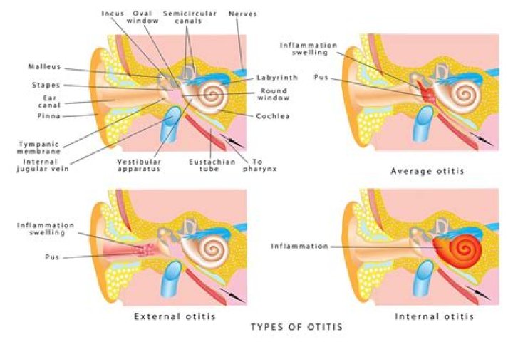 Should i go to er for ear ache?