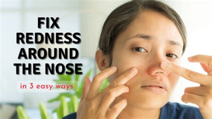 Should inside my nose be red?