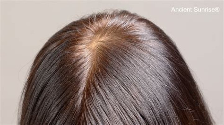 Should roots be darker than hair?