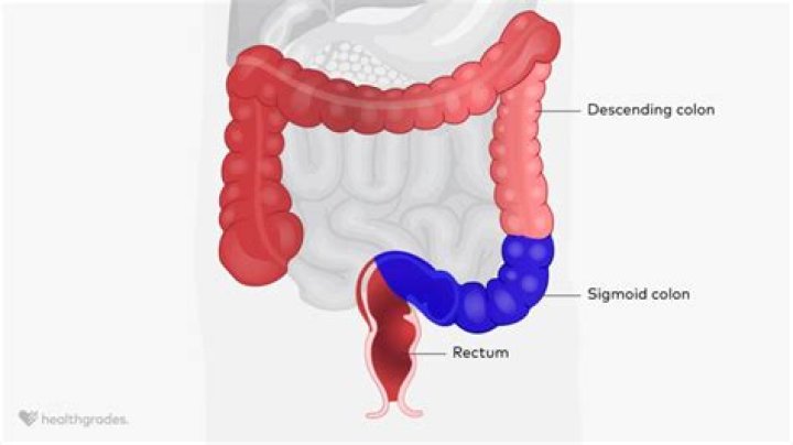 What's absorbed in the colon?