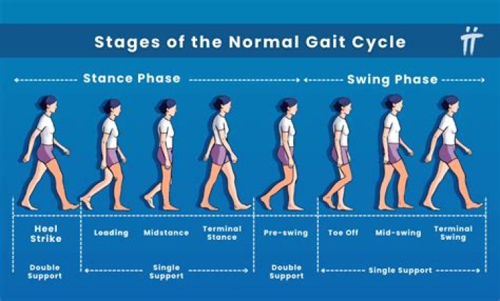 What causes propulsive gait?