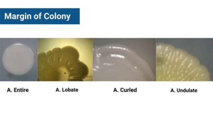 What do you mean by diplobacillus?