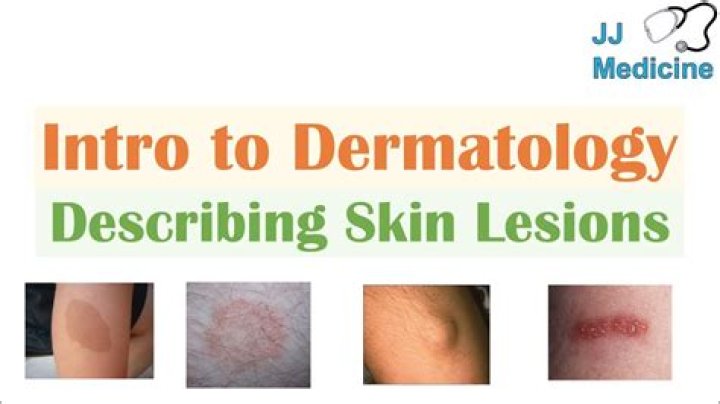 What does dermatolysis mean in medical terms?