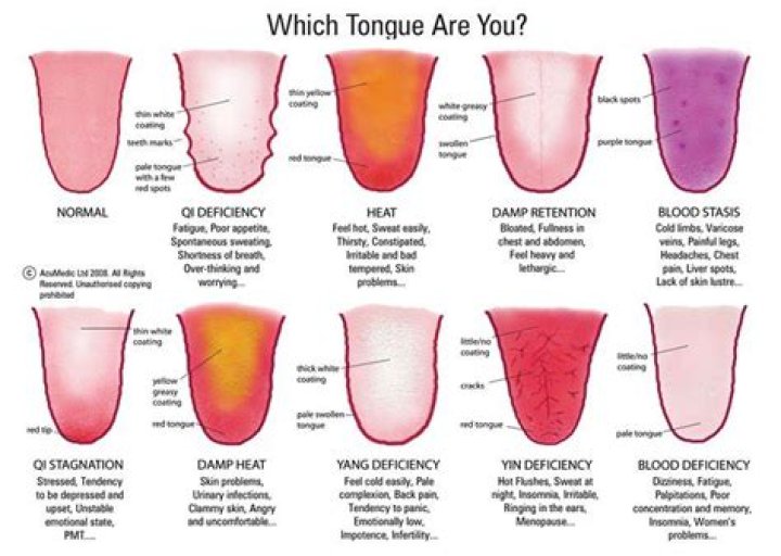 What does pointed tongue mean?